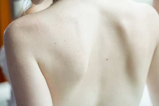 A detailed close-up image of a woman's back, highlighting skin texture and subtle freckles.